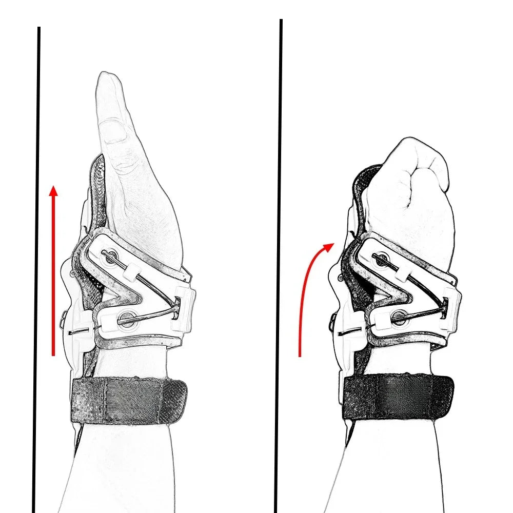 XUP! Протектор за китка